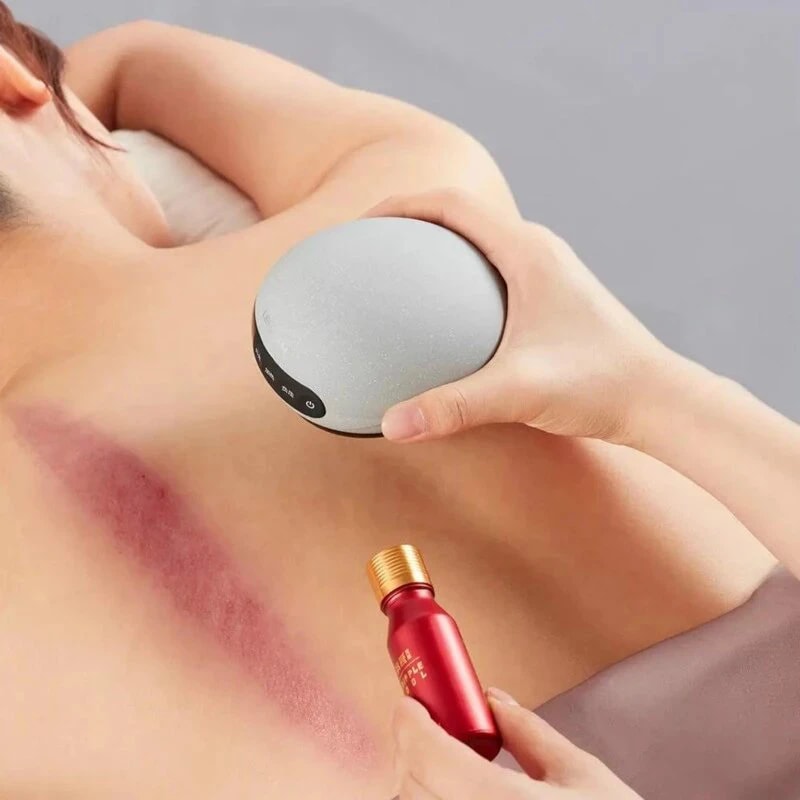 Mi Mini Ventosa and Painless Scraping Device